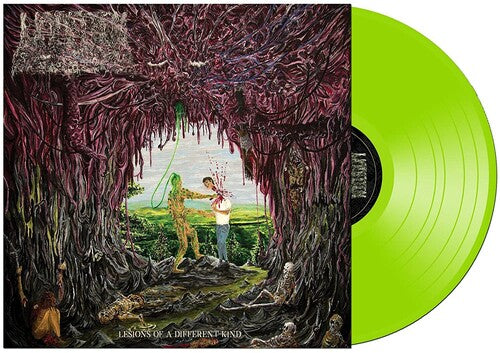 Undeath - Lesions Of A Different Kind [ Vinyl ]